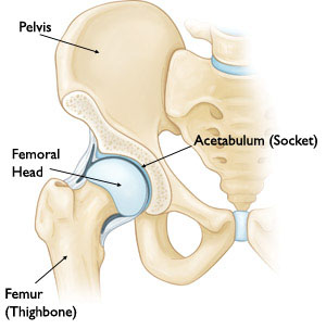 Total Hip Replacement Surgery