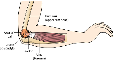 Elbow Arthroscopy Surgery